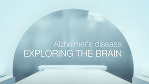 Mechanizmy a tajomstvá Alzheimerovej choroby